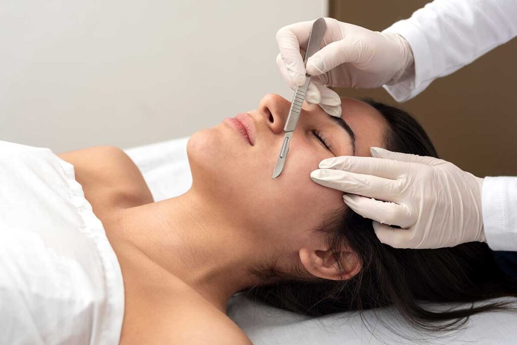 Skin peel treatment
