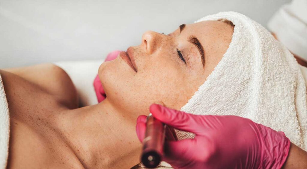 Skin peel treatment
